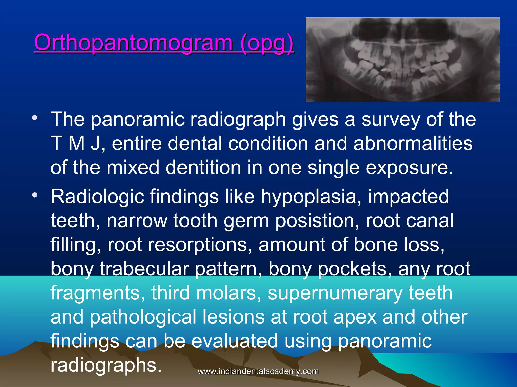 Orthopantomogram (opg)
• The panoramic radiograph gives a survey of the
T M J, entire dental condition and abnormalities
of the mixed dentition in one single exposure.
• Radiologic findings like hypoplasia, impacted
teeth, narrow tooth germ posistion, root canal
filling, root resorptions, amount of bone loss,
bony trabecular pattern, bony pockets, any root
fragments, third molars, supernumerary teeth
and pathological lesions at root apex and other
findings can be evaluated using panoramic
radiographs.
www.indiandentalacademy.com

 