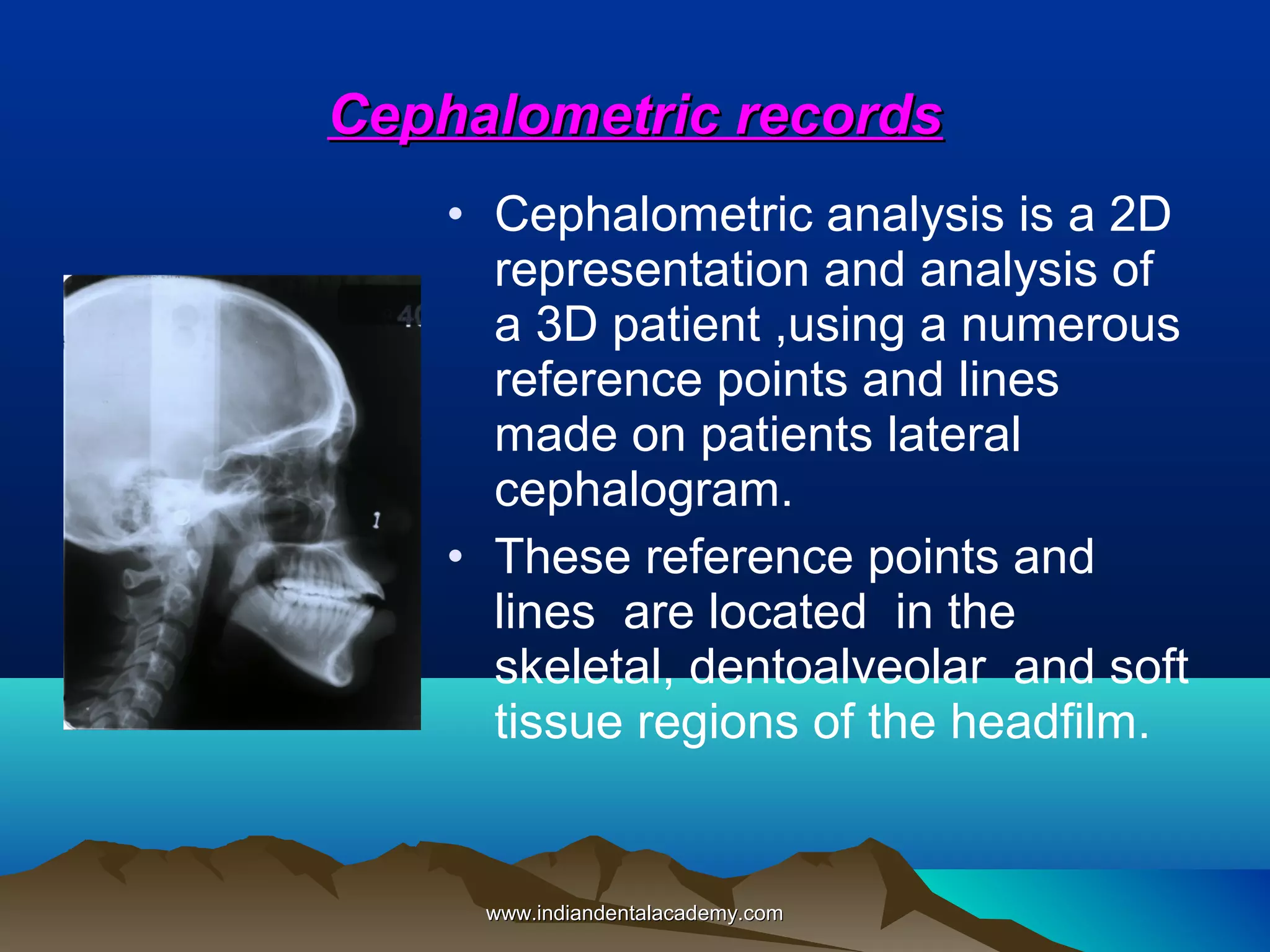 Cephalometric records
• Cephalometric analysis is a 2D
representation and analysis of
a 3D patient ,using a numerous
reference points and lines
made on patients lateral
cephalogram.
• These reference points and
lines are located in the
skeletal, dentoalveolar and soft
tissue regions of the headfilm.

www.indiandentalacademy.com

 