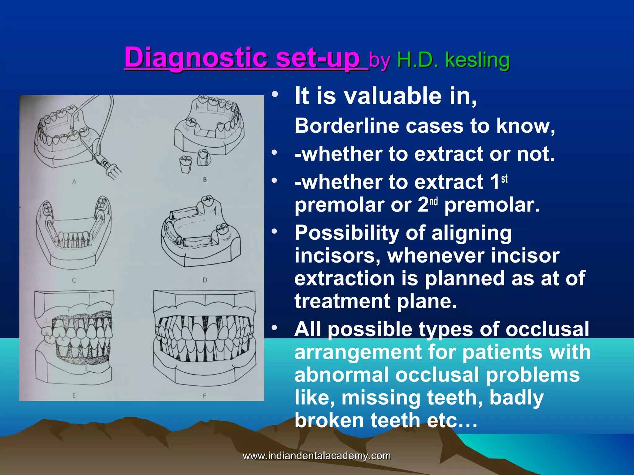Diagnostic set-up by H.D. kesling
• It is valuable in,
•
•
•

•

Borderline cases to know,
-whether to extract or not.
-whether to extract 1st
premolar or 2nd premolar.
Possibility of aligning
incisors, whenever incisor
extraction is planned as at of
treatment plane.
All possible types of occlusal
arrangement for patients with
abnormal occlusal problems
like, missing teeth, badly
broken teeth etc…

www.indiandentalacademy.com

 