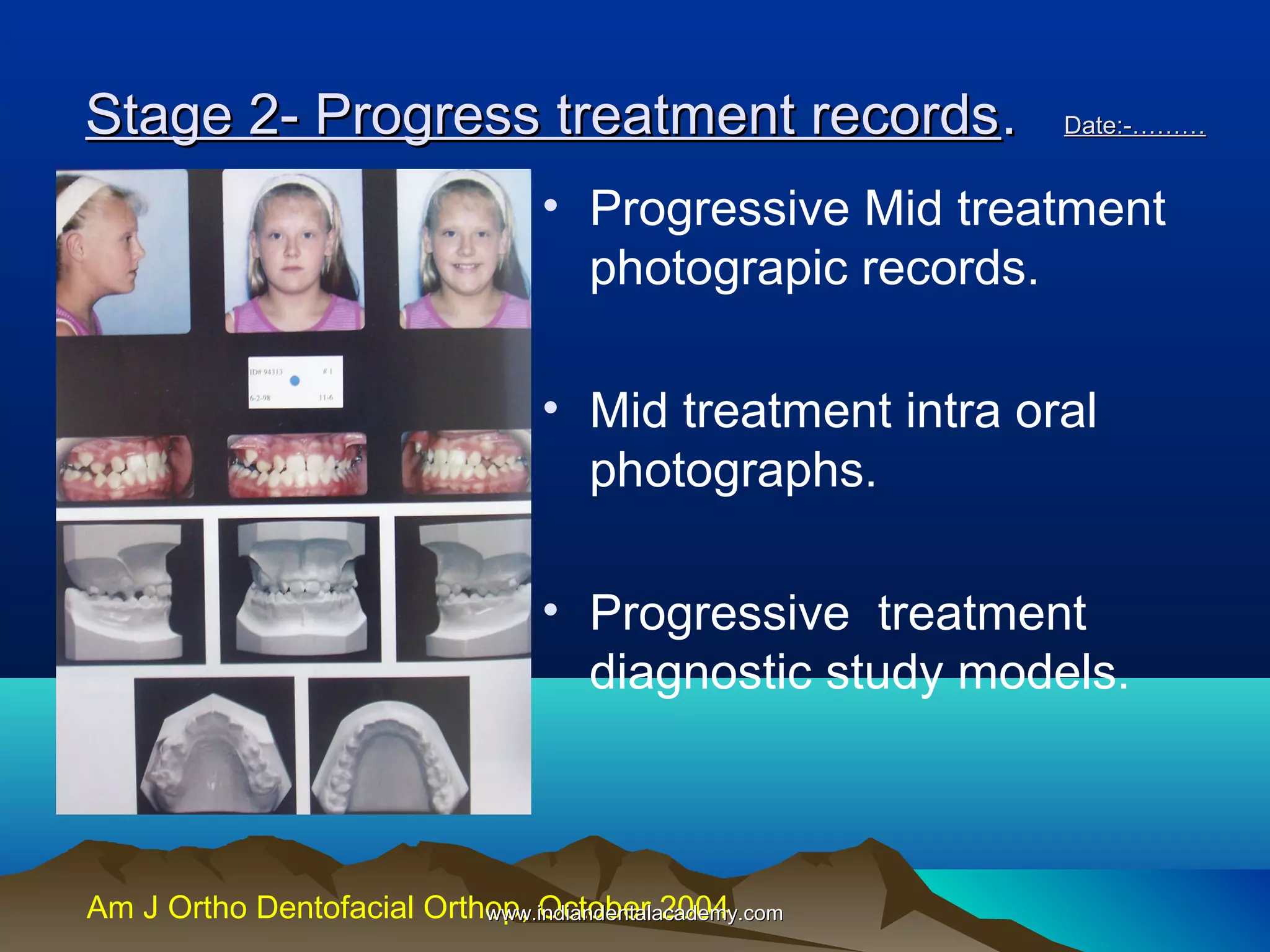 Stage 2- Progress treatment records .

Date:-………

• Progressive Mid treatment
photograpic records.
• Mid treatment intra oral
photographs.
• Progressive treatment
diagnostic study models.

Am J Ortho Dentofacial Orthop, October 2004
www.indiandentalacademy.com

 