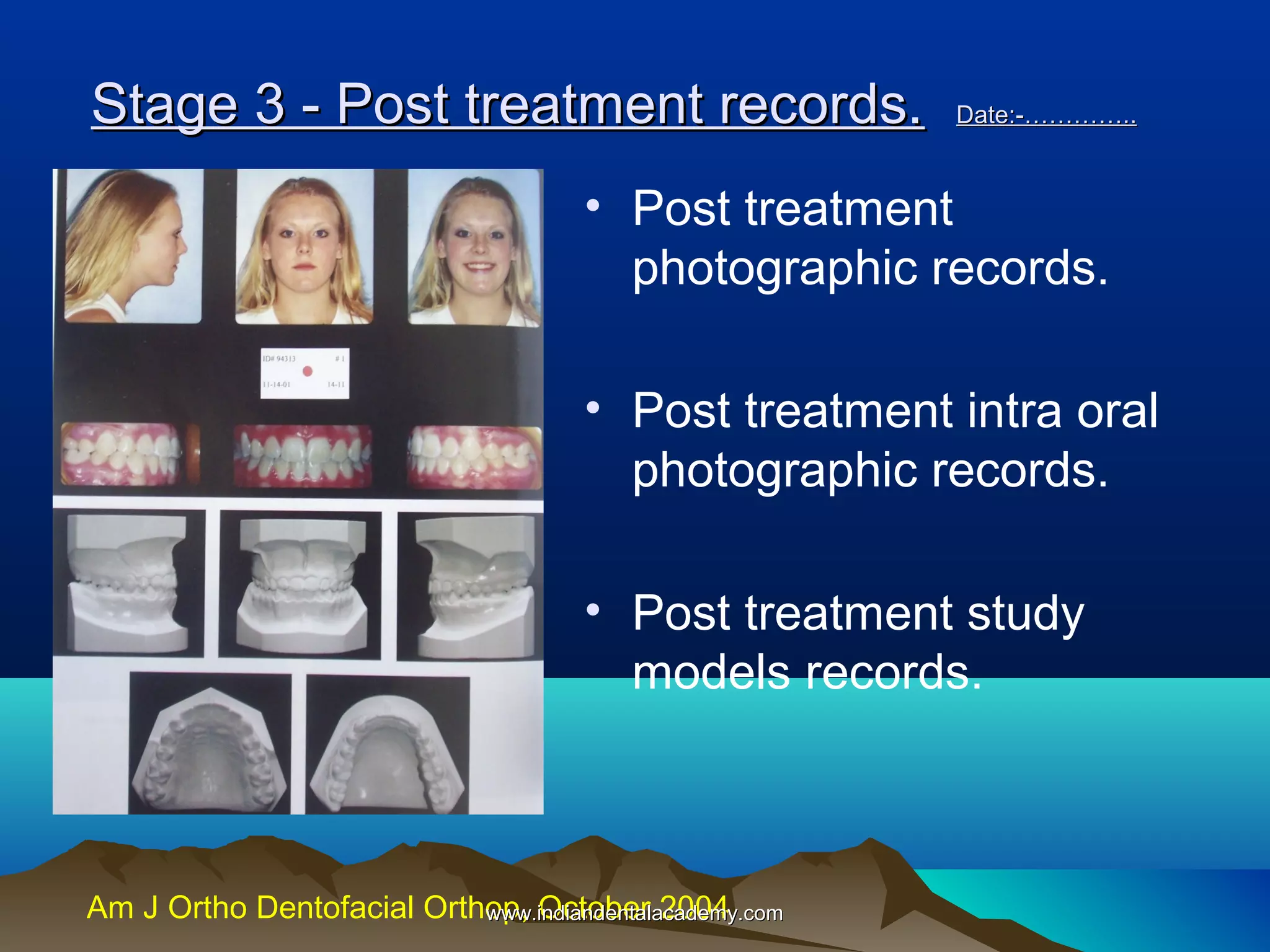Stage 3 - Post treatment records.

Date:-…………..

• Post treatment
photographic records.
• Post treatment intra oral
photographic records.
• Post treatment study
models records.

Am J Ortho Dentofacial Orthop, October 2004
www.indiandentalacademy.com

 