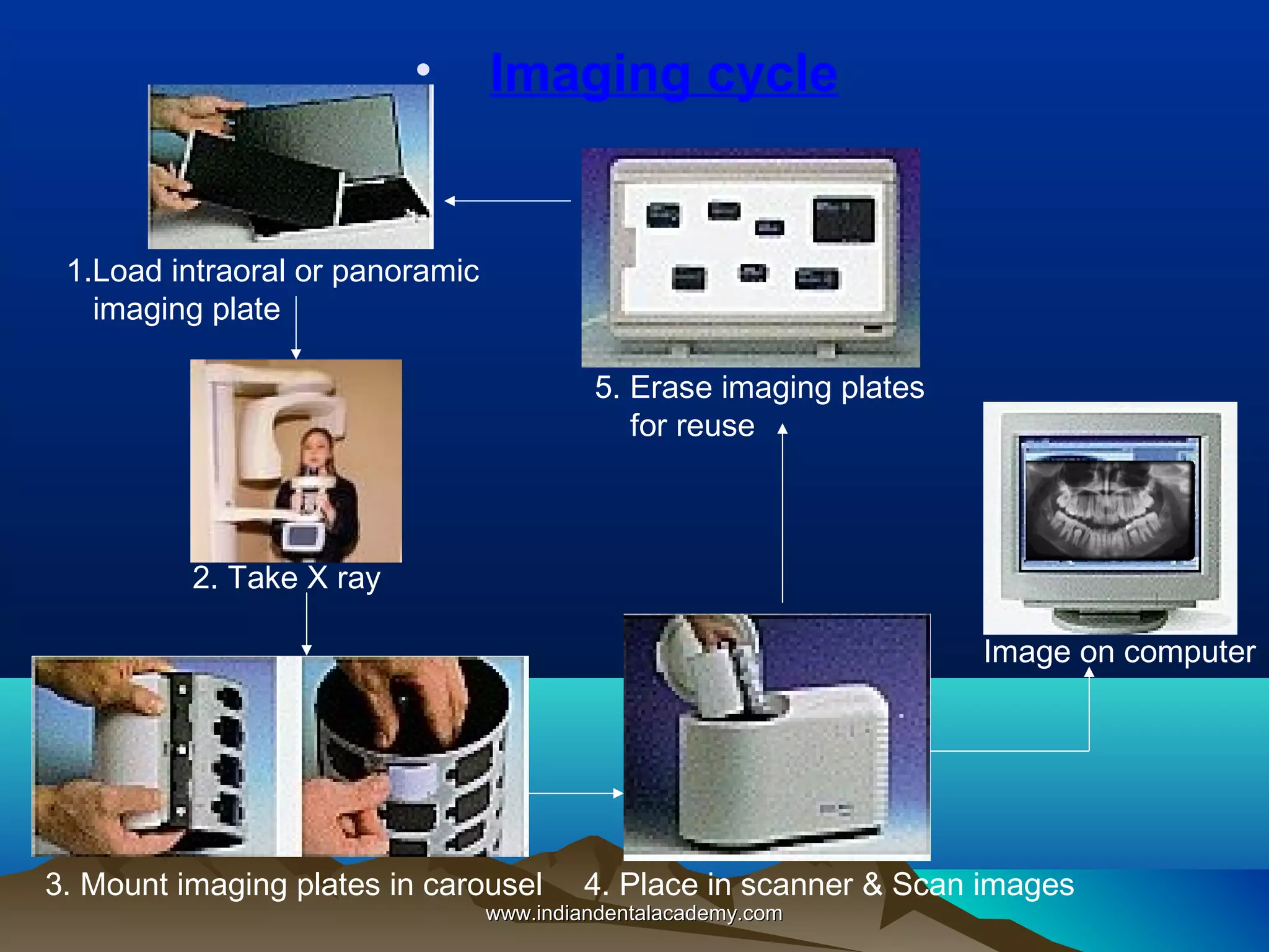 •

Imaging cycle

1.Load intraoral or panoramic
imaging plate
5. Erase imaging plates
for reuse

2. Take X ray
Image on computer

3. Mount imaging plates in carousel

4. Place in scanner & Scan images

www.indiandentalacademy.com

 