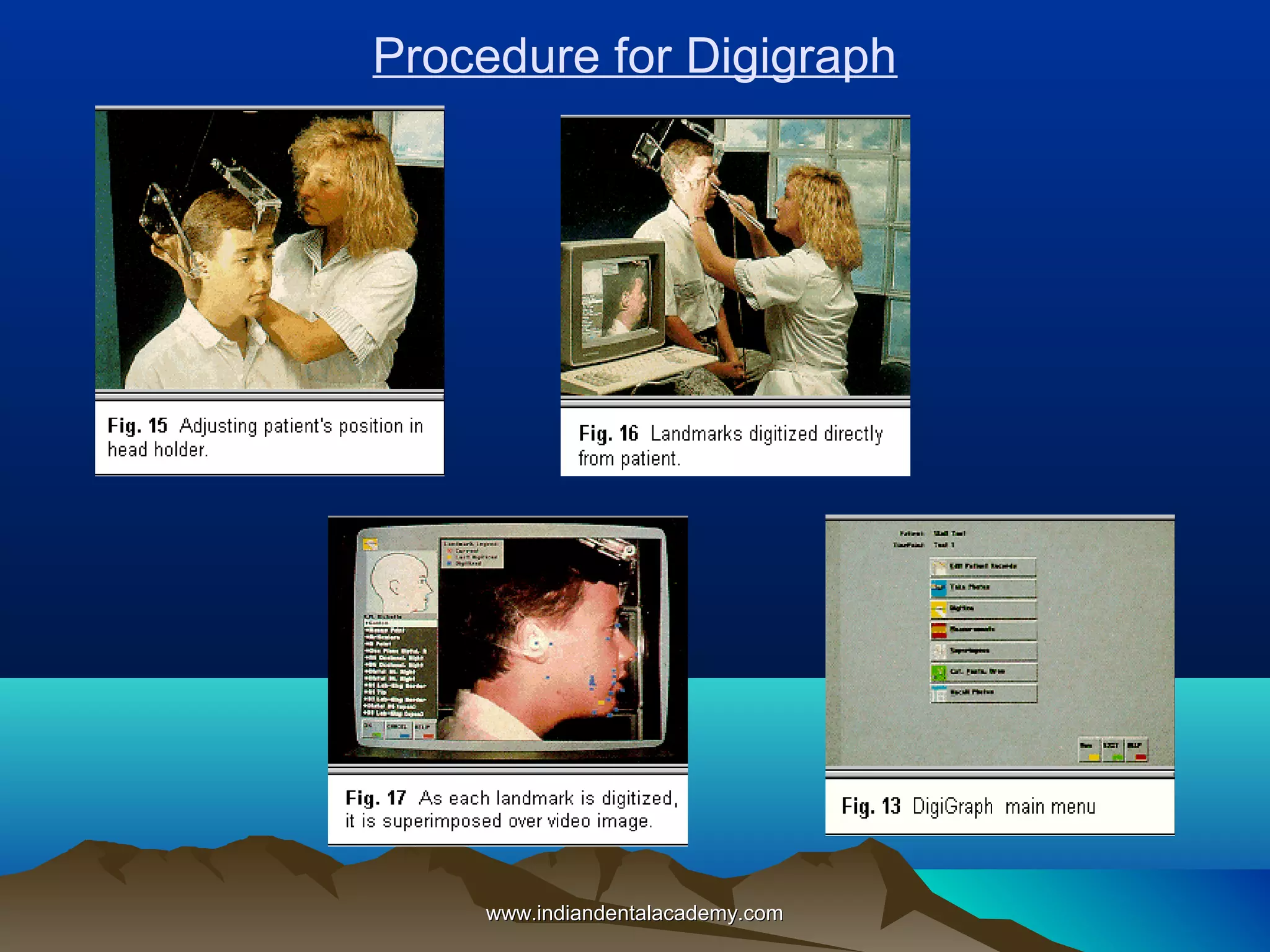 Procedure for Digigraph

www.indiandentalacademy.com

 