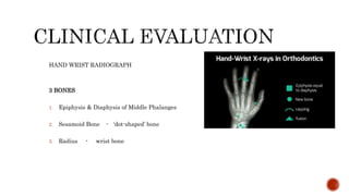 HAND WRIST RADIOGRAPH
3 BONES
1. Epiphysis & Diaphysis of Middle Phalanges
2. Sesamoid Bone - ‘dot-shaped’ bone
3. Radius - wrist bone
 
