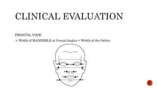 FRONTAL VIEW
 Width of MANDIBLE at Gonial Angles = Width of the Orbits
 