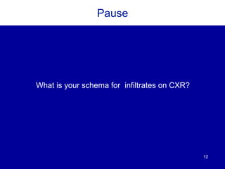 12
Pause
What is your schema for infiltrates on CXR?
 