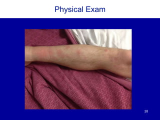 28
Physical Exam
 