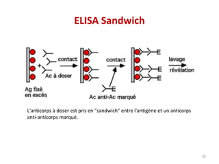 ELISA Sandwich
30
L'anticorps à doser est pris en "sandwich" entre l'antigène et un anticorps
anti-anticorps marqué.
 