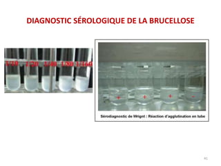 DIAGNOSTIC SÉROLOGIQUE DE LA BRUCELLOSE
41
 