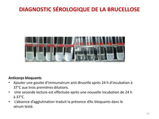 42
Anticorps bloquants
• Ajouter une goutte d'immunsérum anti-Brucella après 24 h d'incubation à
37°C aux trois premières dilutions.
• Une seconde lecture est effectuée après une nouvelle incubation de 24 h
à 37°C.
• L’absence d’agglutination traduit la présence d’Ac bloquants dans le
sérum testé.
DIAGNOSTIC SÉROLOGIQUE DE LA BRUCELLOSE
 