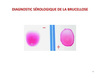 DIAGNOSTIC SÉROLOGIQUE DE LA BRUCELLOSE
44
 