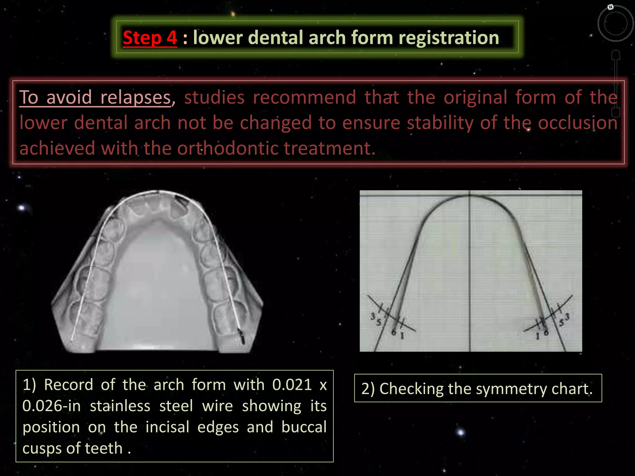 Step 4 : lower dental arch form registration
1) Record of the arch form with 0.021 x
0.026-in stainless steel wire showing its
position on the incisal edges and buccal
cusps of teeth .
2) Checking the symmetry chart.
To avoid relapses, studies recommend that the original form of the
lower dental arch not be changed to ensure stability of the occlusion
achieved with the orthodontic treatment.
 