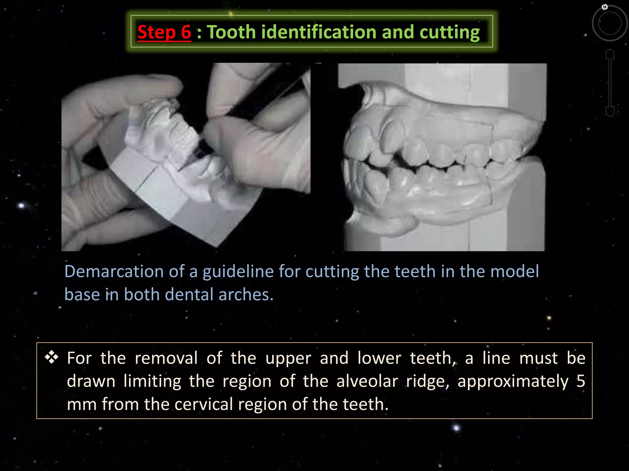 Step 6 : Tooth identification and cutting
Demarcation of a guideline for cutting the teeth in the model
base in both dental arches.
 For the removal of the upper and lower teeth, a line must be
drawn limiting the region of the alveolar ridge, approximately 5
mm from the cervical region of the teeth.
 