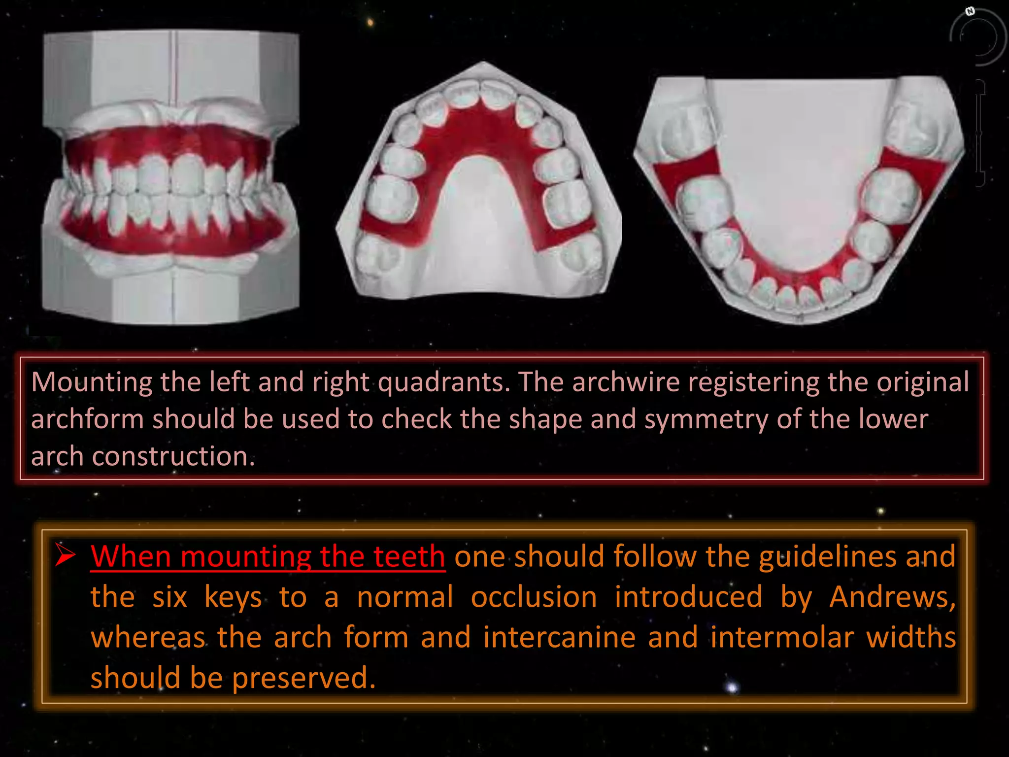 Mounting the left and right quadrants. The archwire registering the original
archform should be used to check the shape and symmetry of the lower
arch construction.
 When mounting the teeth one should follow the guidelines and
the six keys to a normal occlusion introduced by Andrews,
whereas the arch form and intercanine and intermolar widths
should be preserved.
 