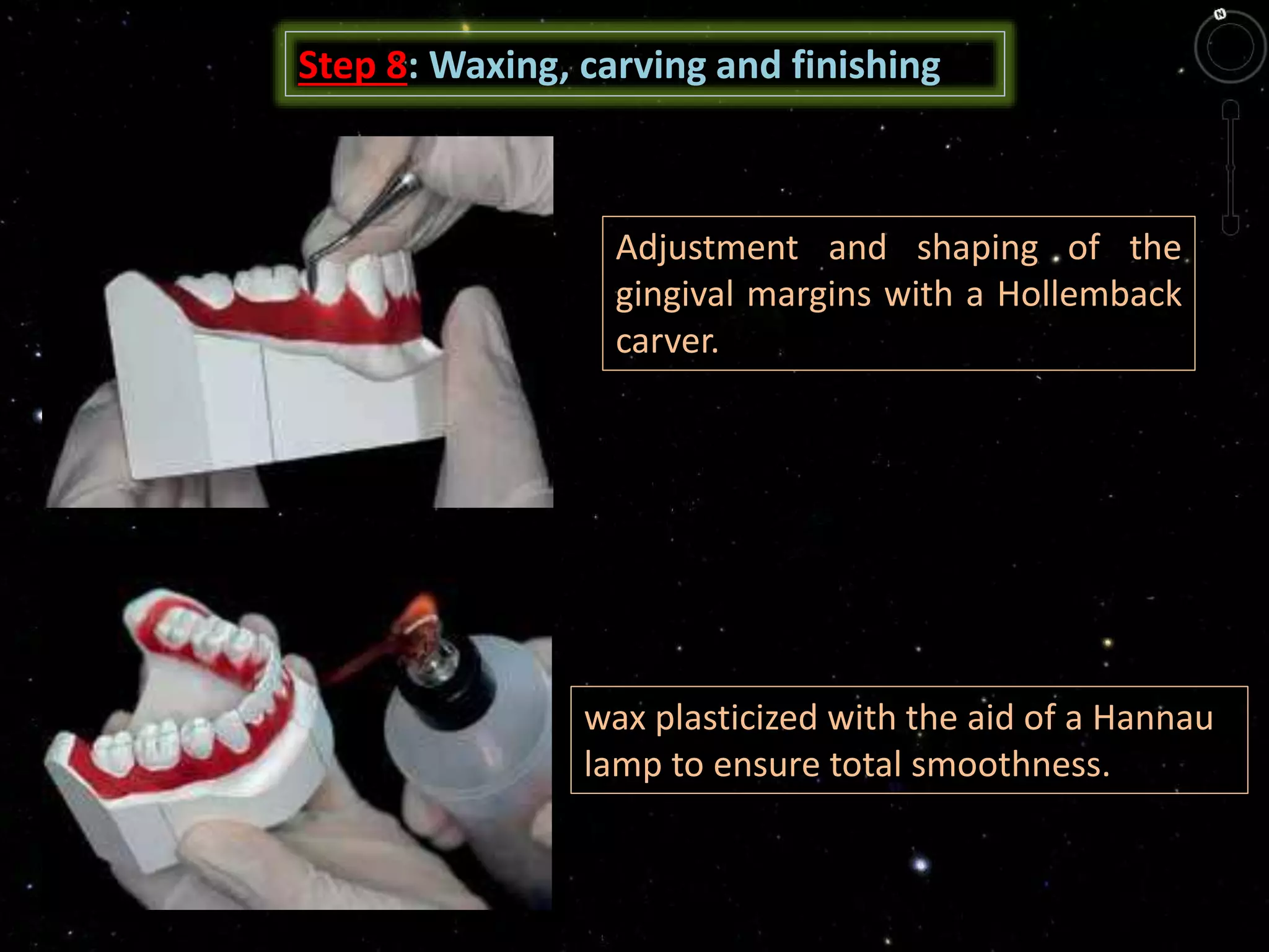Step 8: Waxing, carving and finishing
Adjustment and shaping of the
gingival margins with a Hollemback
carver.
wax plasticized with the aid of a Hannau
lamp to ensure total smoothness.
 