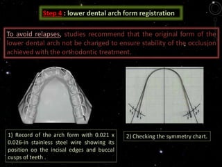 Step 4 : lower dental arch form registration
1) Record of the arch form with 0.021 x
0.026-in stainless steel wire showing its
position on the incisal edges and buccal
cusps of teeth .
2) Checking the symmetry chart.
To avoid relapses, studies recommend that the original form of the
lower dental arch not be changed to ensure stability of the occlusion
achieved with the orthodontic treatment.
 