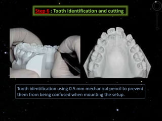 Step 6 : Tooth identification and cutting
Tooth identification using 0.5 mm mechanical pencil to prevent
them from being confused when mounting the setup.
 
