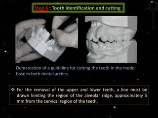 Step 6 : Tooth identification and cutting
Demarcation of a guideline for cutting the teeth in the model
base in both dental arches.
 For the removal of the upper and lower teeth, a line must be
drawn limiting the region of the alveolar ridge, approximately 5
mm from the cervical region of the teeth.
 