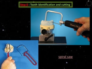 Step 6 : Tooth identification and cutting
spiral saw
 