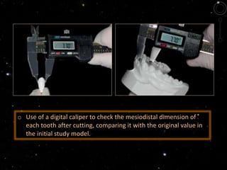 o Use of a digital caliper to check the mesiodistal dimension of
each tooth after cutting, comparing it with the original value in
the initial study model.
 