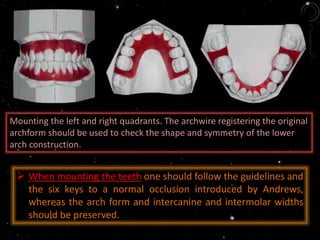 Mounting the left and right quadrants. The archwire registering the original
archform should be used to check the shape and symmetry of the lower
arch construction.
 When mounting the teeth one should follow the guidelines and
the six keys to a normal occlusion introduced by Andrews,
whereas the arch form and intercanine and intermolar widths
should be preserved.
 