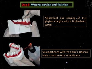 Step 8: Waxing, carving and finishing
Adjustment and shaping of the
gingival margins with a Hollemback
carver.
wax plasticized with the aid of a Hannau
lamp to ensure total smoothness.
 