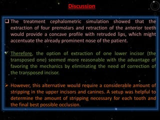  The treatment cephalometric simulation showed that the
extraction of four premolars and retraction of the anterior teeth
would provide a concave profile with retruded lips, which might
accentuate the already prominent nose of the patient.
 Therefore, the option of extraction of one lower incisor (the
transposed one) seemed more reasonable with the advantage of
favoring the mechanics by eliminating the need of correction of
the transposed incisor.
 However, this alternative would require a considerable amount of
stripping in the upper incisors and canines. A setup was helpful to
determine the amount of stripping necessary for each tooth and
the final best possible occlusion.
Discussion
 
