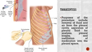 ▪Purposes of the
procedure include
removal of fluid and
air from the pleural
cavity, aspiration of
pleural fluid for
analysis, pleural
biopsy, and
instillation of
medication into the
pleural space.
 