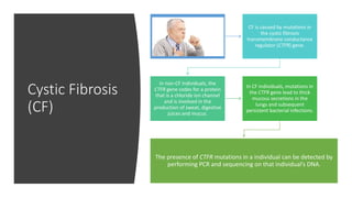 Cystic Fibrosis
(CF)
CF is caused by mutations in
the cystic fibrosis
transmembrane conductance
regulator (CTFR) gene.
In non-CF individuals, the
CTFR gene codes for a protein
that is a chloride ion channel
and is involved in the
production of sweat, digestive
juices and mucus.
In CF individuals, mutations in
the CTFR gene lead to thick
mucous secretions in the
lungs and subsequent
persistent bacterial infections.
The presence of CTFR mutations in a individual can be detected by
performing PCR and sequencing on that individual’s DNA.
 