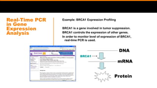 Real-Time PCR
in Gene
Expression
Analysis
Example: BRCA1 Expression Profiling
BRCA1 is a gene involved in tumor suppression.
BRCA1 controls the expression of other genes.
In order to monitor level of expression of BRCA1,
real-time PCR is used.
DNA
mRNA
Protein
BRCA1
 