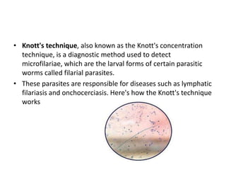 • Knott's technique, also known as the Knott's concentration
technique, is a diagnostic method used to detect
microfilariae, which are the larval forms of certain parasitic
worms called filarial parasites.
• These parasites are responsible for diseases such as lymphatic
filariasis and onchocerciasis. Here's how the Knott's technique
works
 