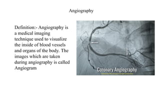 Angiogram Def Diagnostic techniques of cardiac diseases.pptx