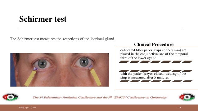 diagnostic techniques of dry eye schirmer test