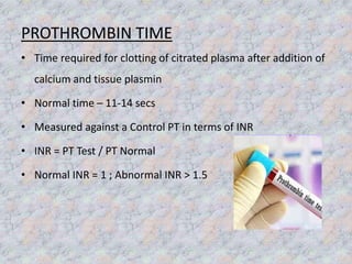 Prothrombin Normal Diagnostic test and investigation in periodontology | PPTX