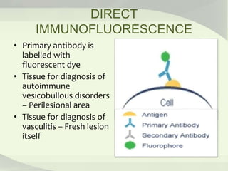 DIRECT
IMMUNOFLUORESCENCE
• Primary antibody is
labelled with
fluorescent dye
• Tissue for diagnosis of
autoimmune
vesicobullous disorders
– Perilesional area
• Tissue for diagnosis of
vasculitis – Fresh lesion
itself
 