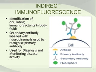 INDIRECT
IMMUNOFLUORESCENCE
• Identification of
circulating
immunoreactants in body
fluids
• Secondary antibody
labelled with
fluorochrome is used to
recognise primary
antibody
• Used for Diagnosis and
Monitoring disease
activity
 