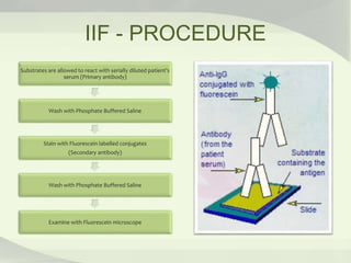 IIF - PROCEDURE
Substrates are allowed to react with serially diluted patient’s
serum (Primary antibody)
Wash with Phosphate Buffered Saline
Stain with Fluorescein labelled conjugates
(Secondary antibody)
Wash with Phosphate Buffered Saline
Examine with Fluorescein microscope
 