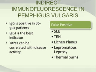 INDIRECT
IMMUNOFLUORESCENCE IN
PEMPHIGUS VULGARIS
• IgG is positive in 80-
90% patients
• IgG1 is the best
indicator
• Titres can be
correlated with disease
activity
False Positive
•SLE
•TEN
•Lichen Planus
•Lepromatous
Leprosy
•Thermal burns
 