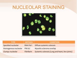 NUCLEOLAR STAINING
TYPE ANTIGEN CONDITION
Speckled nucleolar RNA Pol I Diffuse systemic sclerosis
Homogenous nucleolar PM-Scl Myositis scleroma overlap
Clumpy nucleolar Fibrillarin Systemic sclerosis (Lung and heart, few joints)
 