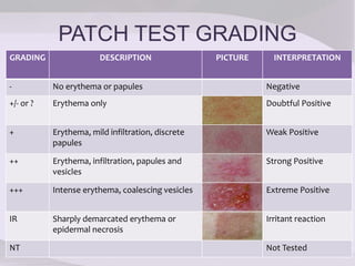 PATCH TEST GRADING
GRADING DESCRIPTION PICTURE INTERPRETATION
- No erythema or papules Negative
+/- or ? Erythema only Doubtful Positive
+ Erythema, mild infiltration, discrete
papules
Weak Positive
++ Erythema, infiltration, papules and
vesicles
Strong Positive
+++ Intense erythema, coalescing vesicles Extreme Positive
IR Sharply demarcated erythema or
epidermal necrosis
Irritant reaction
NT Not Tested
 