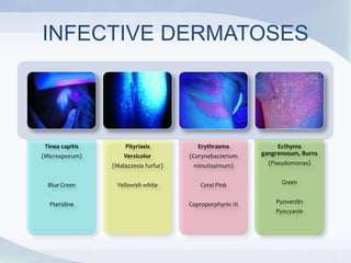 INFECTIVE DERMATOSES
Tinea capitis
(Microsporum)
Blue Green
Pteridine
Pityriasis
Versicolor
(Malazzesia furfur)
Yellowish white
Erythrasma
(Corynebacterium
minutissimum)
Coral Pink
Coproporphyrin III
Ecthyma
gangrenosum, Burns
(Pseudomonas)
Green
Pyoverdin
Pyocyanin
 