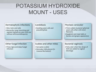 POTASSIUM HYDROXIDE
MOUNT - USES
Dermatophytic infections
•Skin, hairs and nails
•Retractile, long, branching and
septate hyphae are seen with our
without arthroconidiospores
Candidiasis
•Budding yeast cells and
pseudohyphae
Pityriasis versicolor
•Thick walled clustered spherical
yeast cells often with short
filaments
•Spaghetti and meat balls or
banana and grapes appearance
Other fungal infection
•Tinea nigra and deep fungal
infection
Scabies and other mites
•Sarcoptes scabiei
•Demodex folliculorum (in
rosacea like lesions)
Bacterial vaginosis
•Fishy odor when few drops of
KOH are added to vaginal
discharge
 