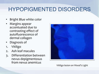 HYPOPIGMENTED DISORDERS
• Bright Blue white color
• Margins appear
accentuated due to
contrasting effect of
autofluorescence of
dermal collagen
• Diagnosis of
1. Vitiligo
2. Ash leaf macules
3. Differentiation between
nevus depigmentosus
from nevus anemicus
Vitiligo lesion on Wood’s Light
 