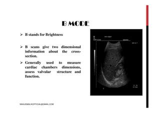 B MODE
 B stands for Brightness
 B scans give two dimensional
information about the cross-
section.
 Generally used to measure
cardiac chambers dimensions,
assess valvular structure and
function.
MAAJIDMALIKOFFICIAL@GMAIL.COM
 