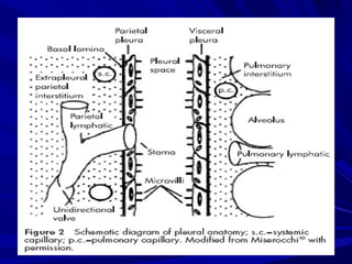 Diagnostic value of pleural effusion | PPT