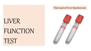 Vial used of liver function test
LIVER
FUNCTION
TEST
 