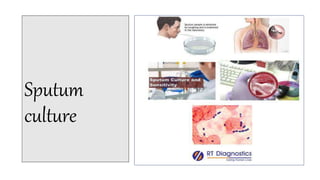 Sputum
culture
 