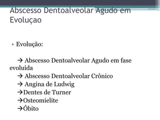 Abscesso Dentoalveolar Agudo em
Evoluçao
• Evolução:
 Abscesso Dentoalveolar Agudo em fase
evoluída
 Abscesso Dentoalveolar Crônico
 Angina de Ludwig
Dentes de Turner
Osteomielite
Óbito
 