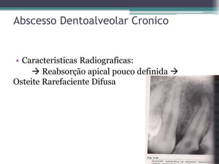 Abscesso Dentoalveolar Cronico
• Caracteristicas Radiograficas:
 Reabsorção apical pouco definida 
Osteite Rarefaciente Difusa
 