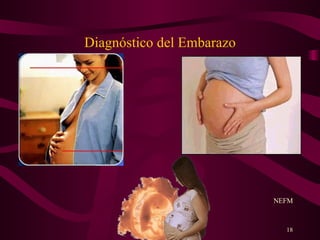 Diagnóstico del Embarazo NEFM 